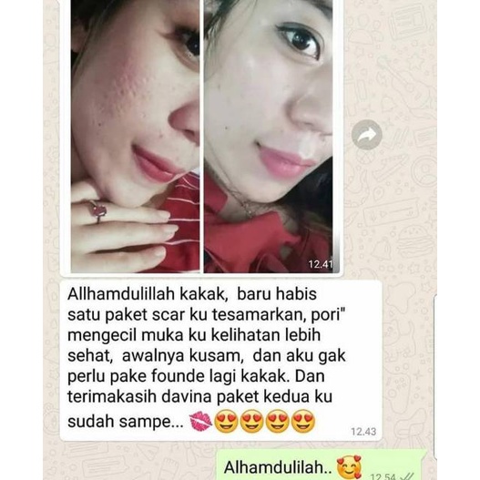Daviena Skincare Serum HA | Serum Bopeng