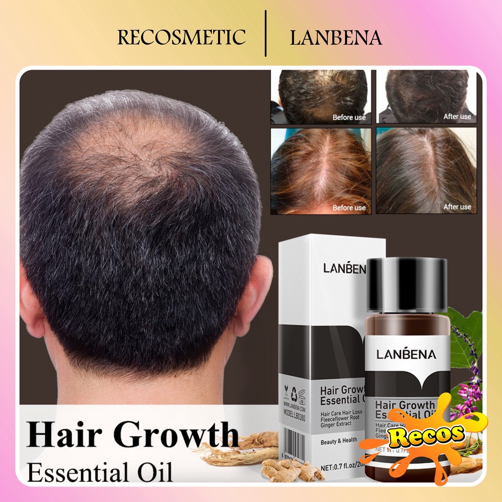 LANBENA Hair Growth Essential Oil - Mencegah Kerontokan (20 ml) [BPOM]