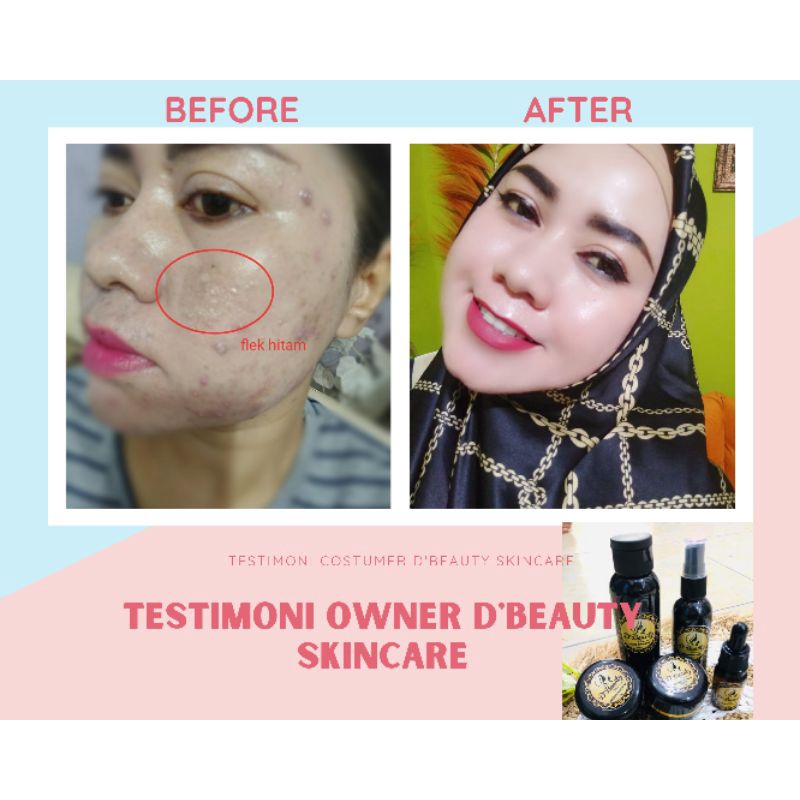 D'Beauty skincare REAL testimoni