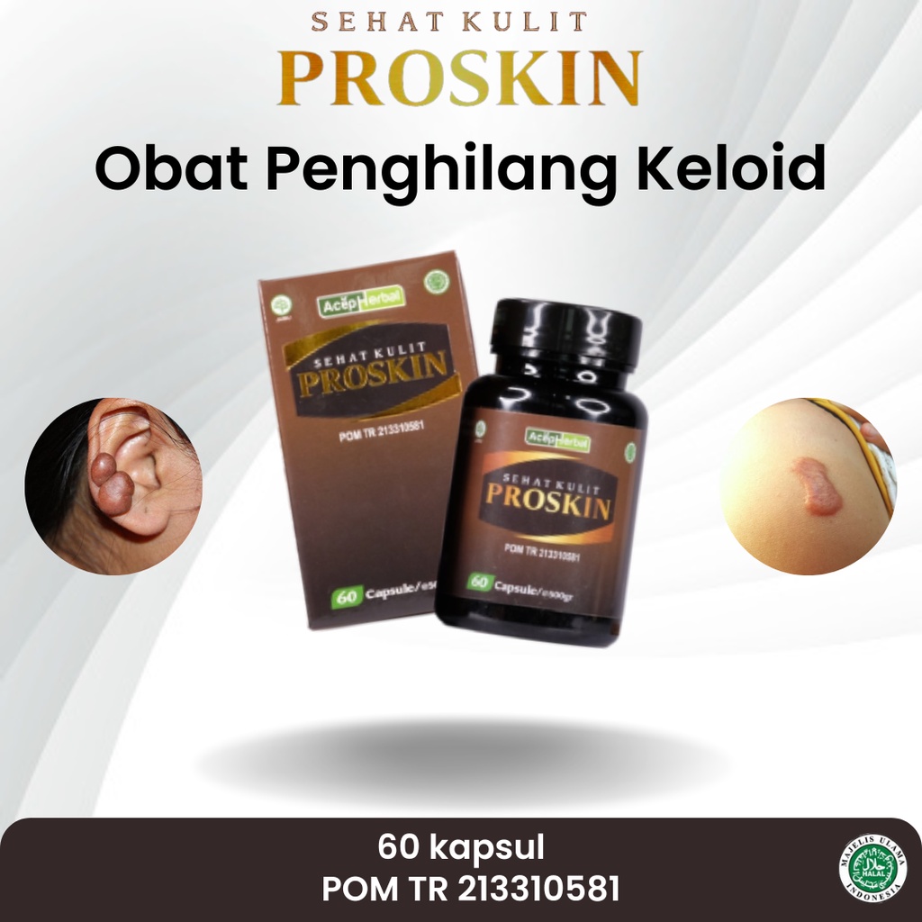 Jual Obat Penghilang Keloid Keloid Menahun Keloid Menonjol Daging Tumbuh Keloid Di Telinga 1935