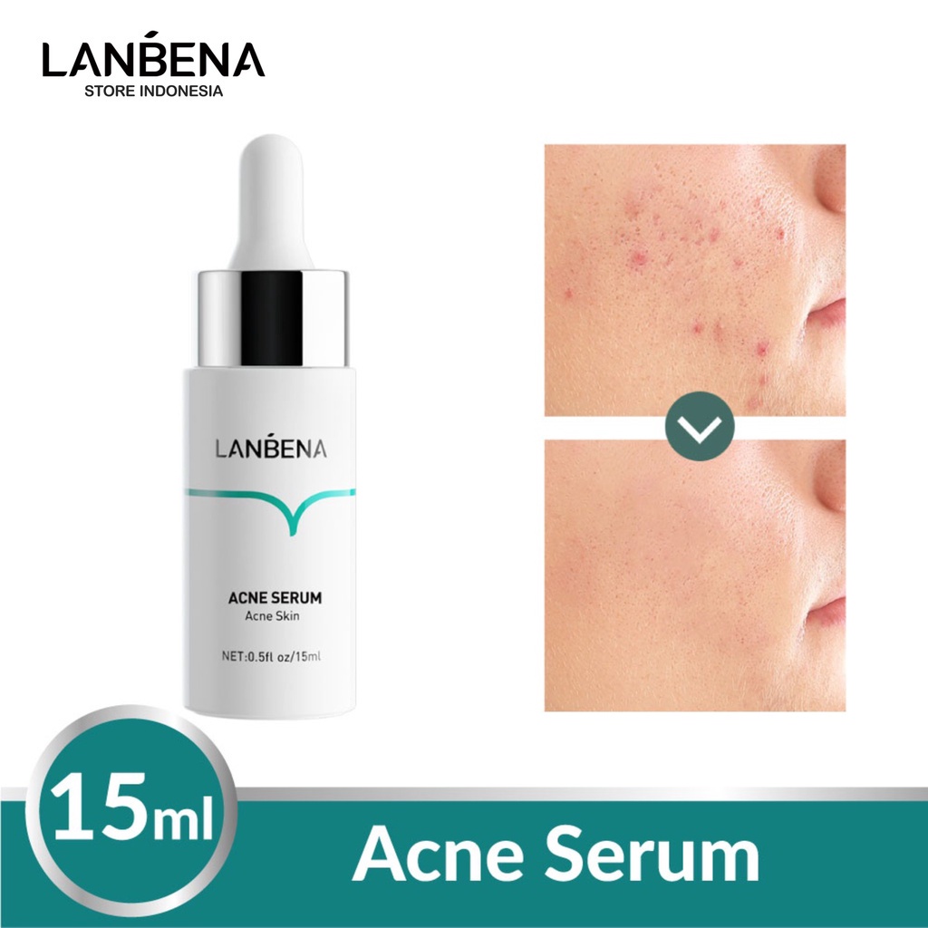 LANBENA Acne Serum - Wajah Berjerawat (15ml)