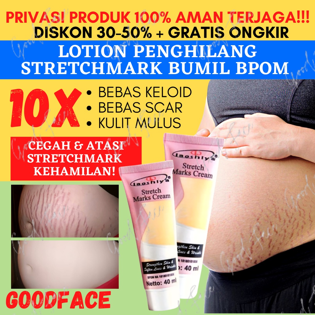 LAOSHIYA STRETCH MARKS CREAM PENGHILANG STRECHMARK ORIGINAL BPOM PENGHILANG BEKAS LUKA