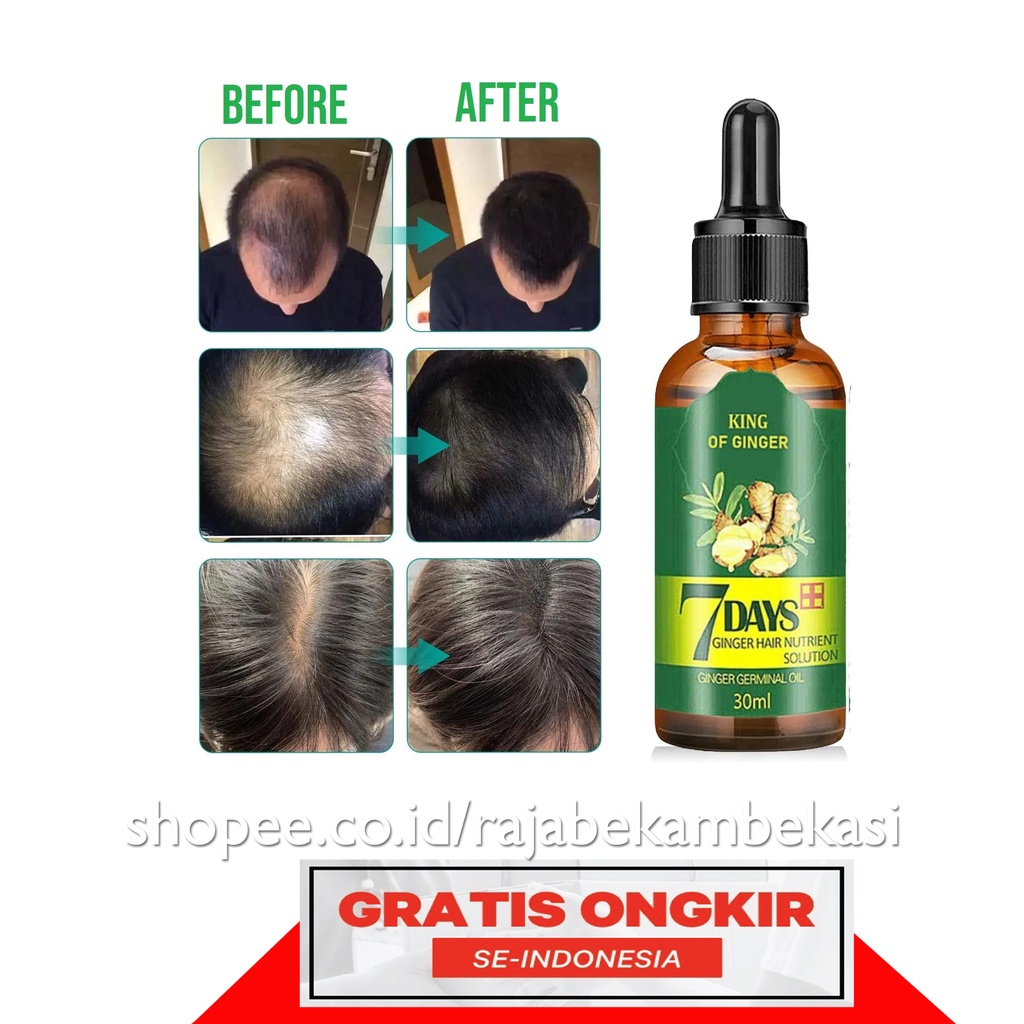 serum penumbuh rambut terbaik original Ginger Hair