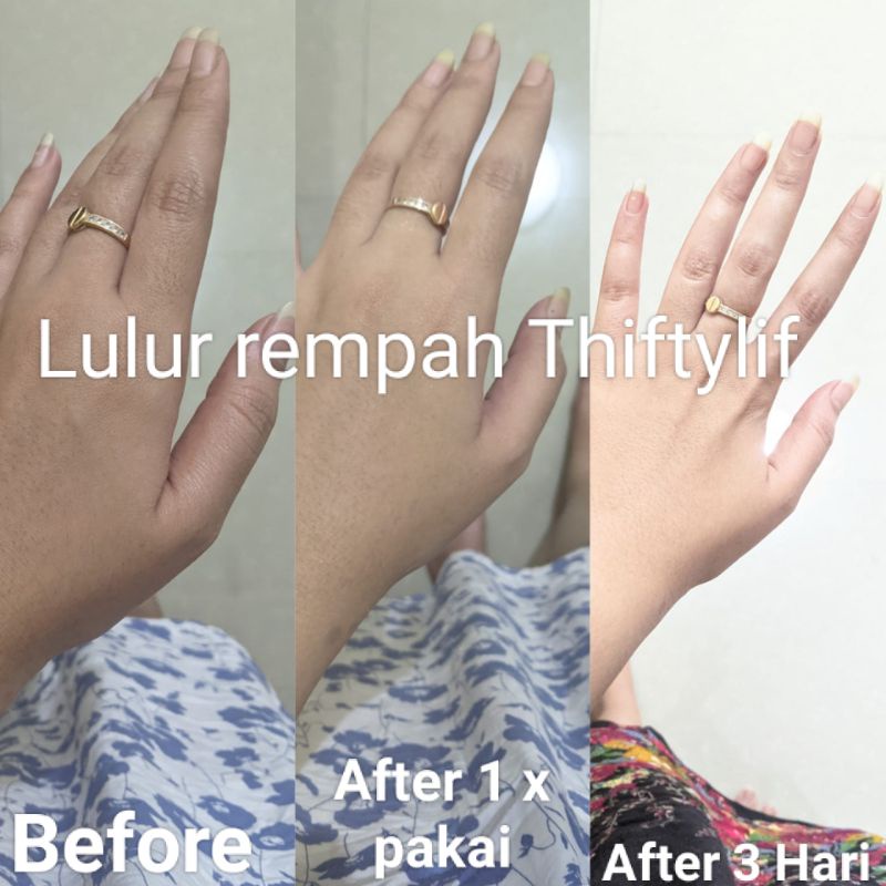 Pemutih Wajah dan Badan Alami Lulur Rempah Ampuh Hilangkan bekas Luka