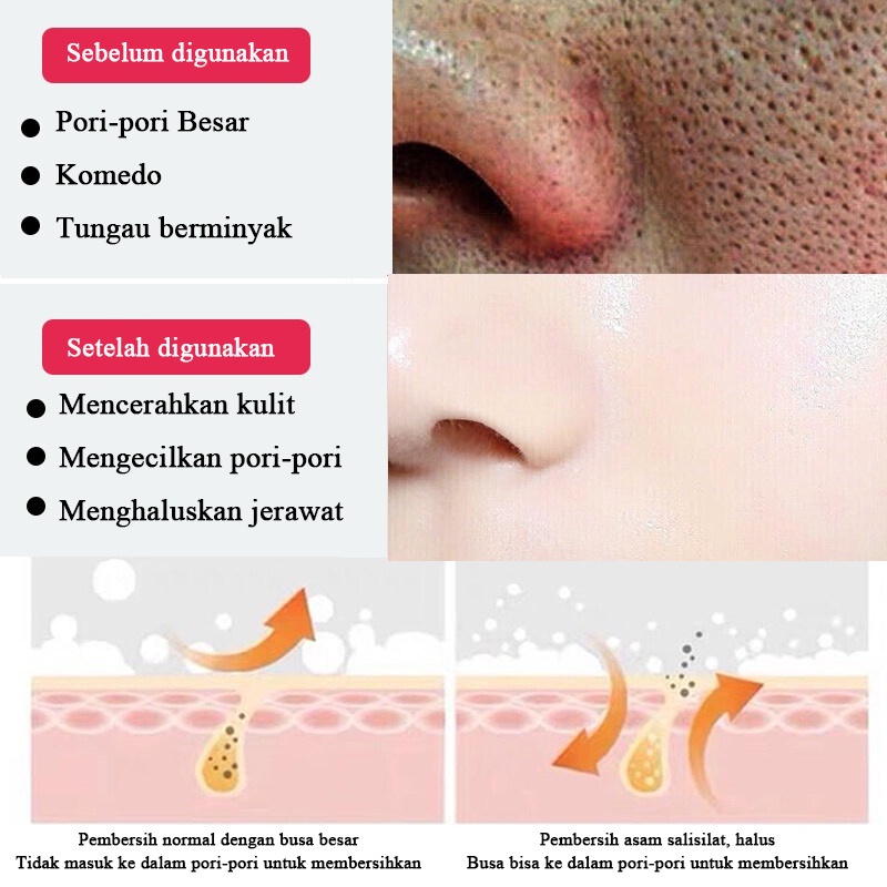 Face Wash For Men Acnes Cuci Muka Pria komedo Pembersih muka acnes 150g Anti-Acne  Membersihkan pori Kontrol minyak