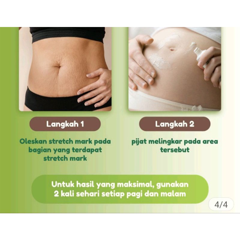 Stretch Mark Cream Pelembab Kulit Atasi Selulit by Momz