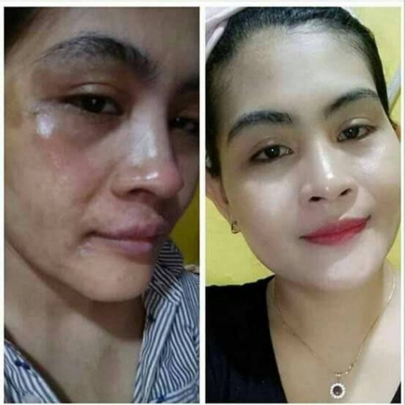 ELCY BEAUTY paket whitening flex kusam glowing mulus elcy beauty &amp; dermaplus