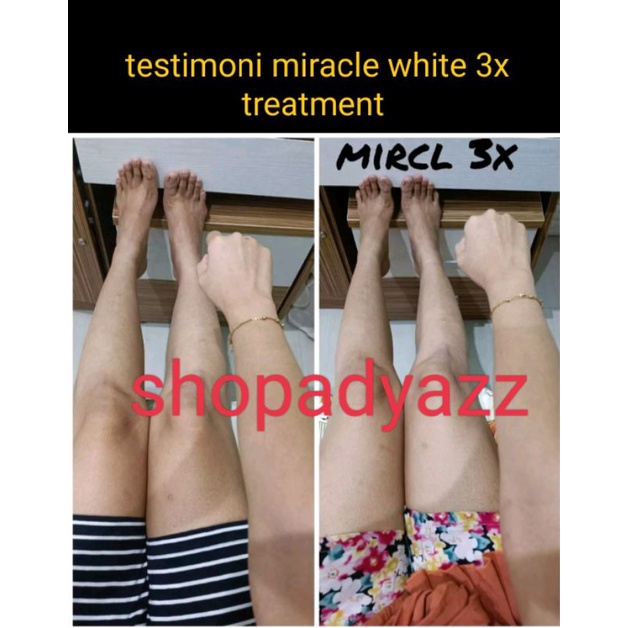 MW NEW SET Miracle white glow new improve new formula ecer