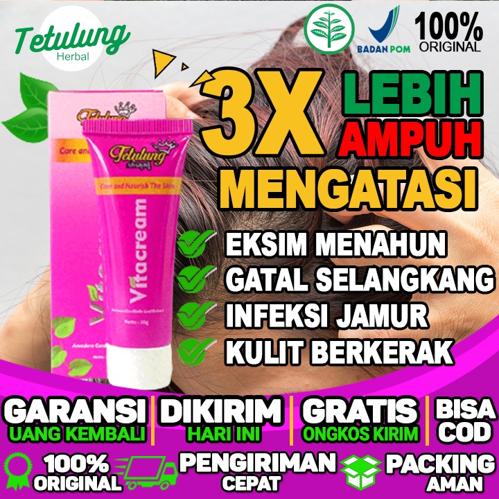 Obat Penghilang Gatal Di Kepala Karena Infeksi Jamur Dan Mengurangi Gatal