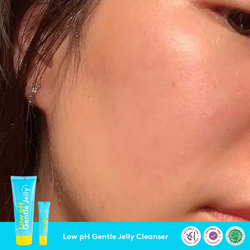 [NEW] SOMETHINC Low pH Gentle Jelly Cleanser - Sabun Cuci Muka Semua Jenis Kulit