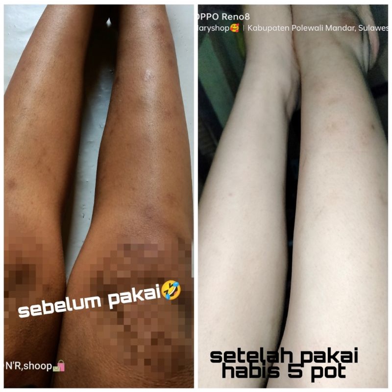 Body Lotion  GLOW SKIN(GS)