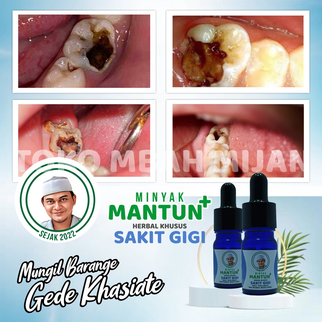 Mantun Biru Herbal Sakit Gigi Berlubang