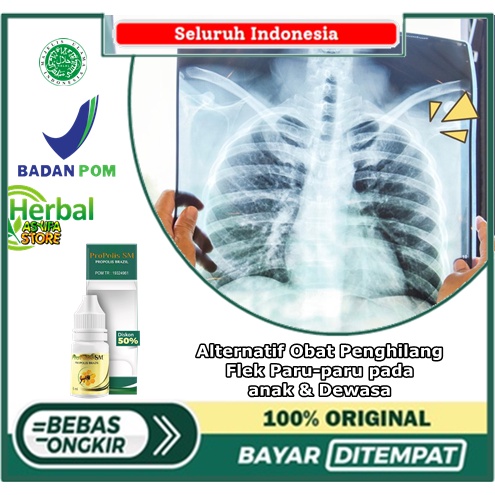 Alternatif Obat Penghilang Flek Paru-paru pada anak & Dewasa - Paru Kering - Bercak Infiltrat Paru -