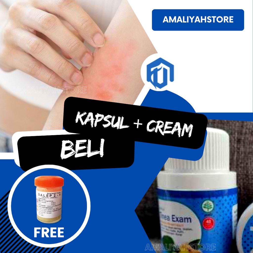 Tinea Exam Original Obat Kapsul Gatal-Gatal Ampuh Salep Krim Gatal Kulit Kadas Panu Eksim Menahun Di Kaki Selangkangan Pria Dan Wanita Paling Ampuh Permanen