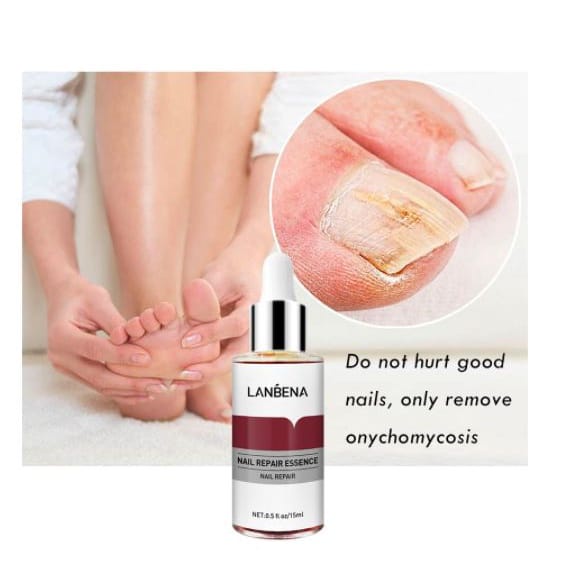 LANBENA NAIL REPAIR PERAWATAN ESSENCE SERUM JAMUR KUKU ESSENCE OIL SERUM NAIL TREATMENT