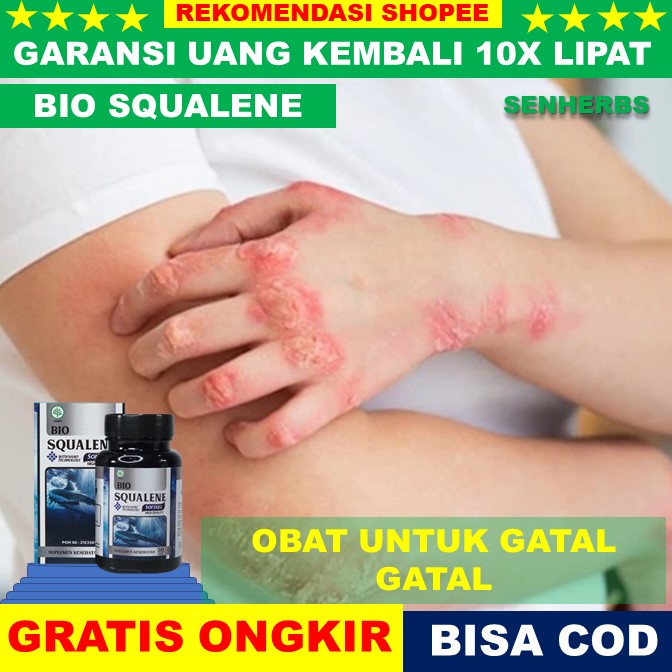 obat gatal kulit  Obat Gatal Seluruh Badan, Obat Penghilang Gatal Kulit, Obat Kulit Eksim, Obat Gata