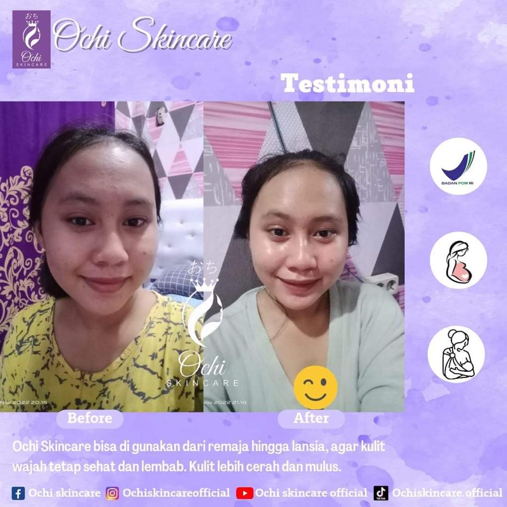 OCHI skincare PLATINUM original paket perawatan premium bpom pemutih wajah aman/SKINCARE WANITA AMAN BPOM