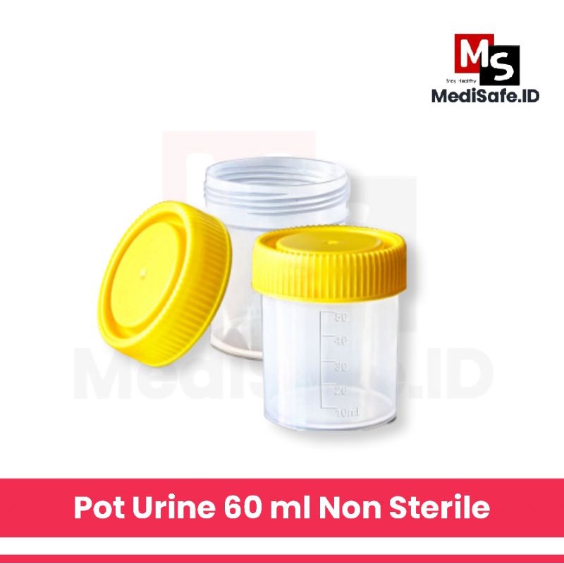 Jual Pot Urine OM Pot Sample 60 Ml Pot Urin Non Steril Shopee Indonesia