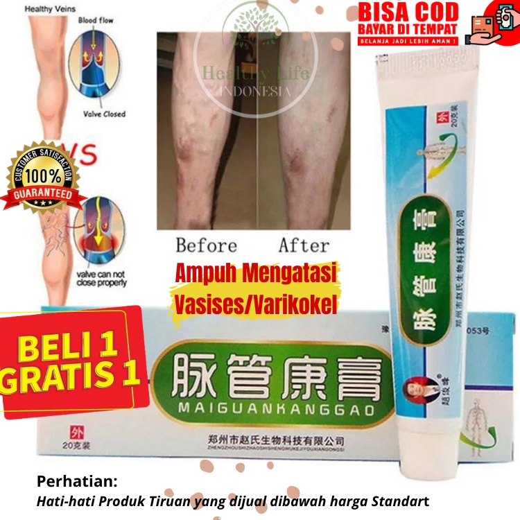 HEALTHYLIFE - Salep Varises Obat China Cina Maiguankanggao Original Obat Varises Nodul Vaskulitis Va