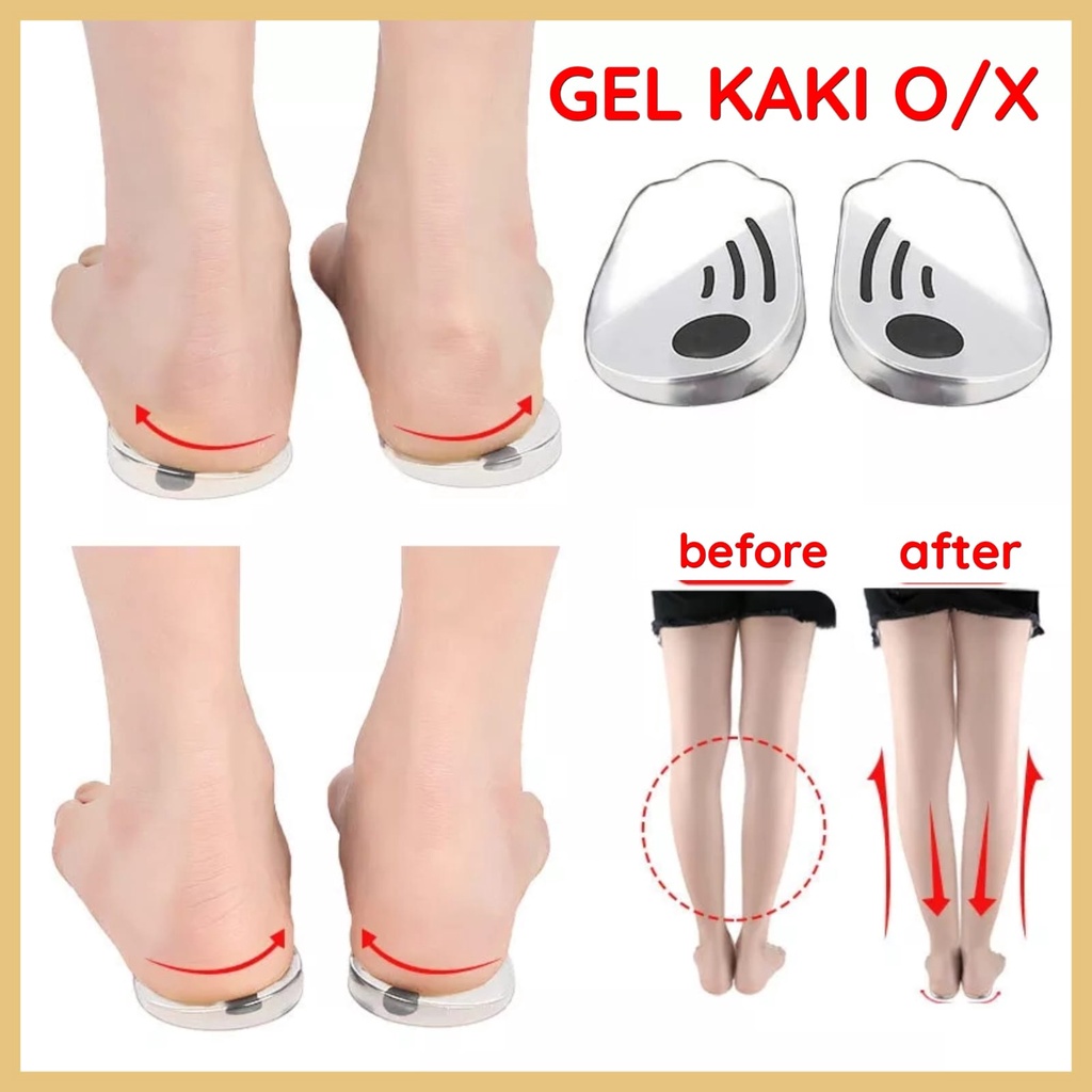 INSOLE GEL SILIKON KAKI O/X OX TATAKAN SEPATU GEL PRIA WANITA SOL SEPATU