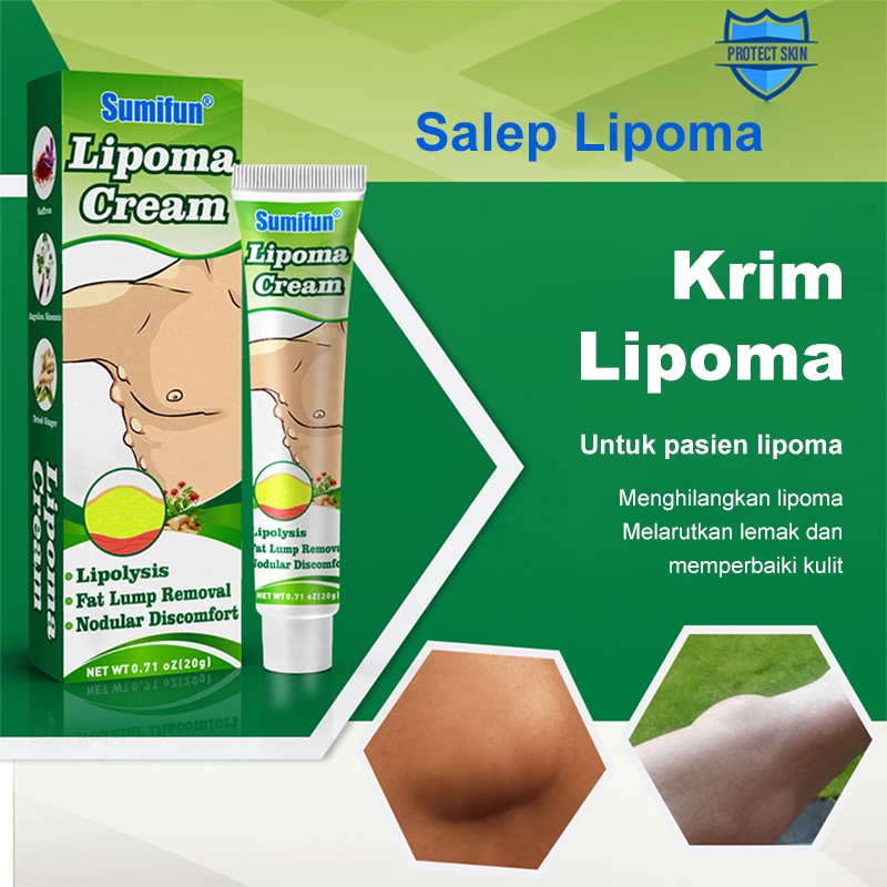 OBAT OLES PENGHILANG BENJOLAN LIPOMA Krim lipoma Obat Benjolan Lipoma 30g Perawatan punggung/leher/paha Kanker Tumor Kelenjar Tiroid Lipoma