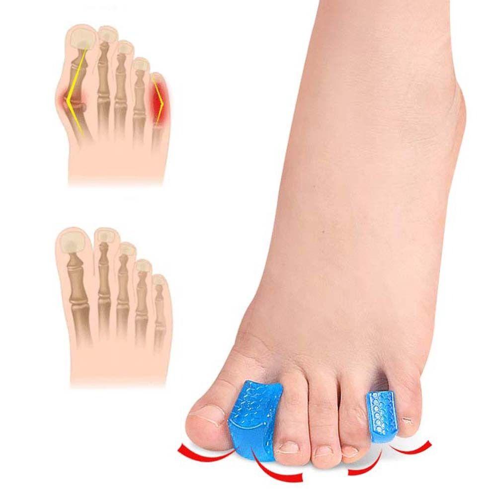 Mxbeauty Toe Splint Separator Nyaman Unisex Alat Perawatan Kaki Foot Valgus Corrector Bunion Protector Pelurus Jari Kaki