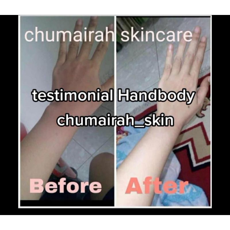 Skincare CH pencerah dan penghalus kulit