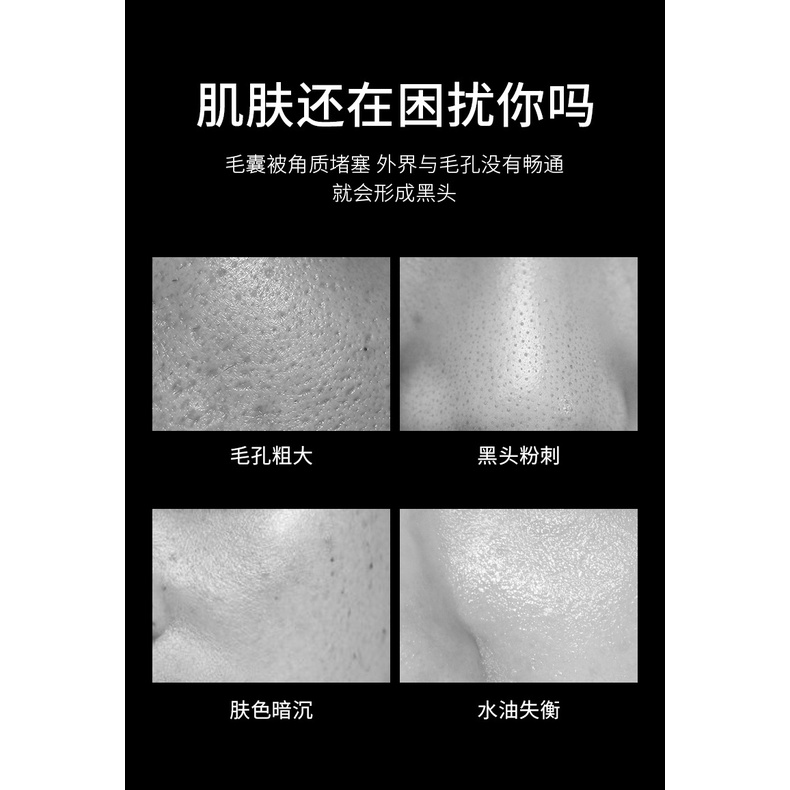 [BPOM] -Veze Blackhead Remover Cleansing Masker Wajah Peel Off 60 Gr/Removed Black Head Original/ Masker Wajah Peel Off Jerawat