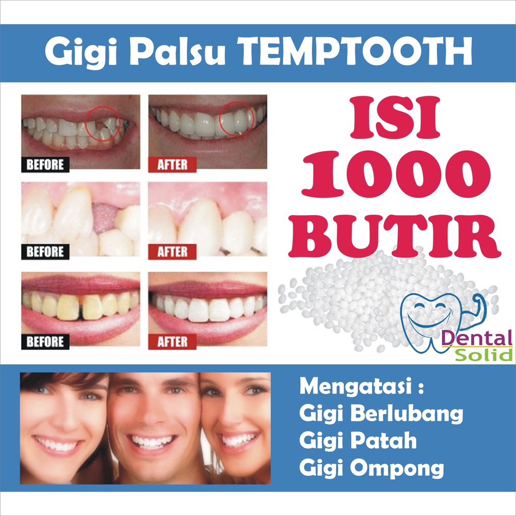 1000 BUTIR / TEMPTOOTH / Gigi Palsu Permanen / Penambal Gigi / Gigi Palsu