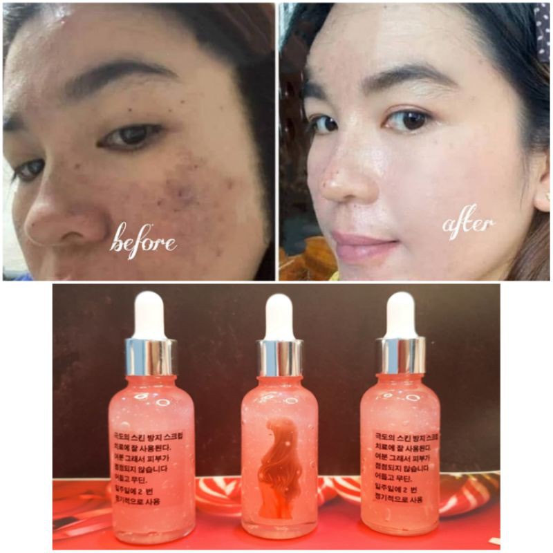 SERUM WAJAH MULGWA GLOWING KOREA MEMBUAT WAJAH PUTIH CERAH GLOW MULUS PEMUTIH PENCERAH KULIT WAJAH M
