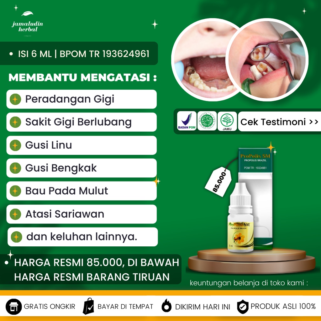 Obat SakitGigi Berlubang, Obat Sakit Gigi Keropok, Obat kumur Sakit Gigi Herbal Propolis SM BRAZIL
