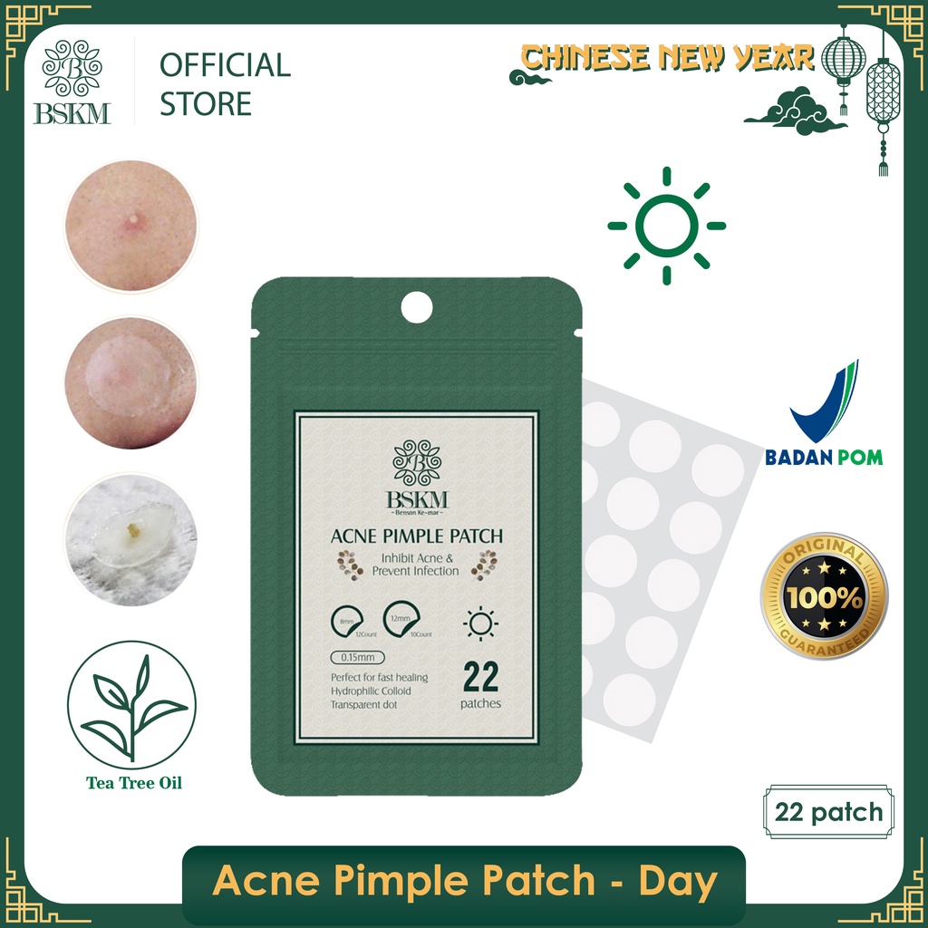 Jual BSKM Acne Pimple Patch Day - Penghilang & Stiker Jerawat 12mm 8mm