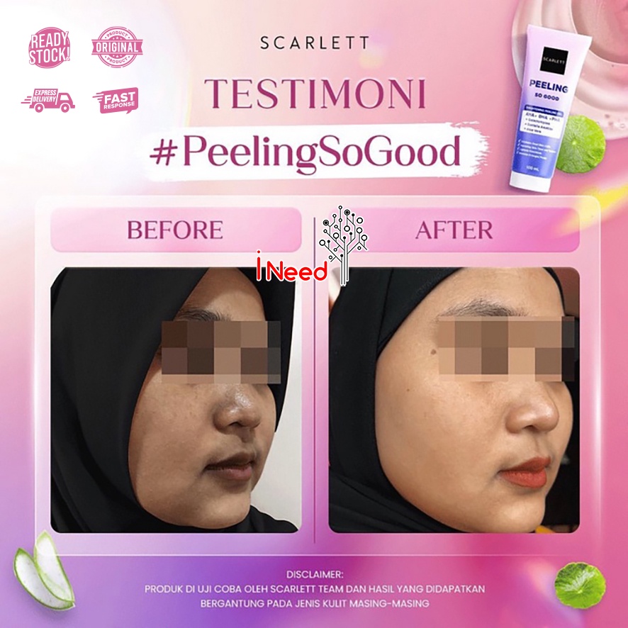 (INEED) Scarlett Whitening Peeling So Good | Brightening Peeling Gel 100ml BPOM Original by Felicya Angelista