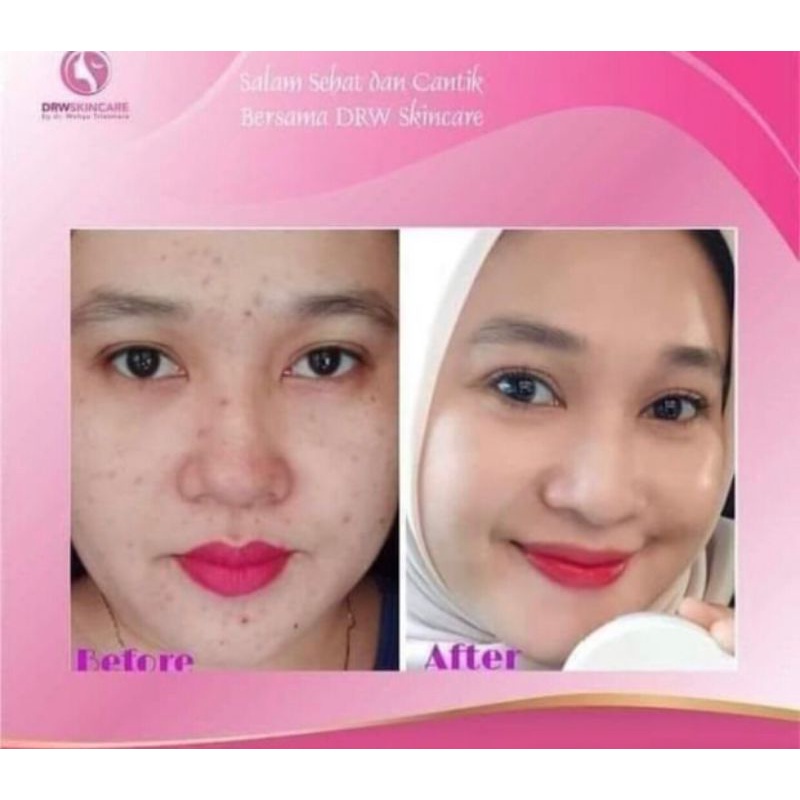 READY CREAM MALAM RADIANT DRW SKINCARE 100% ORIGINAL