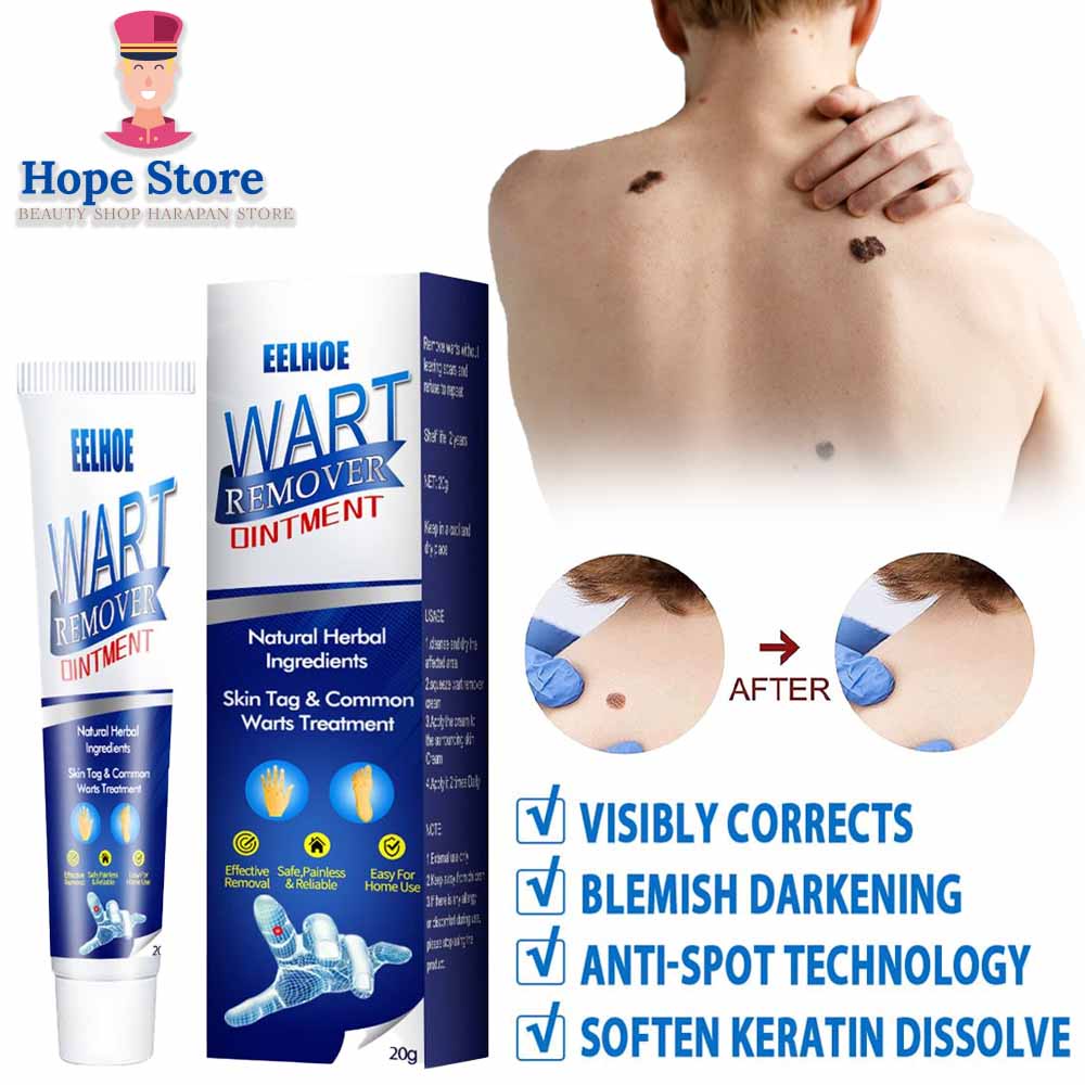 Hope Store  - Sumifun EELHOE Wart Remover Cream Herbal Natural Ampuh Menghilangkan Kutil Dan Tahi Lalat