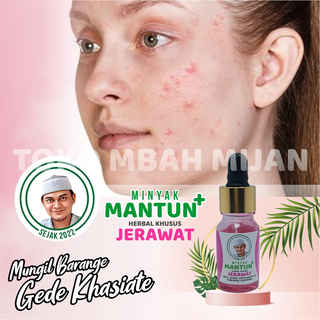 Mantun Pink Herbal Jerawat Batu