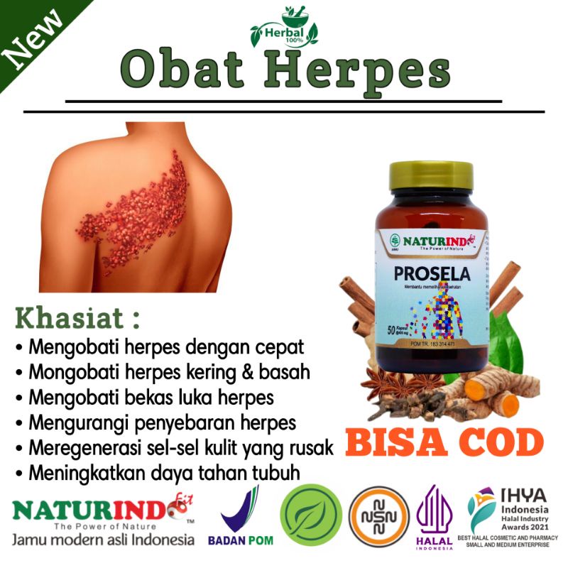 OBAT HERPES KULIT PALING AMPUH OBAT HERPES GENITAL OBAT CACAR DI WAJAH HERBAL GATAL KULIT NATURINDO 