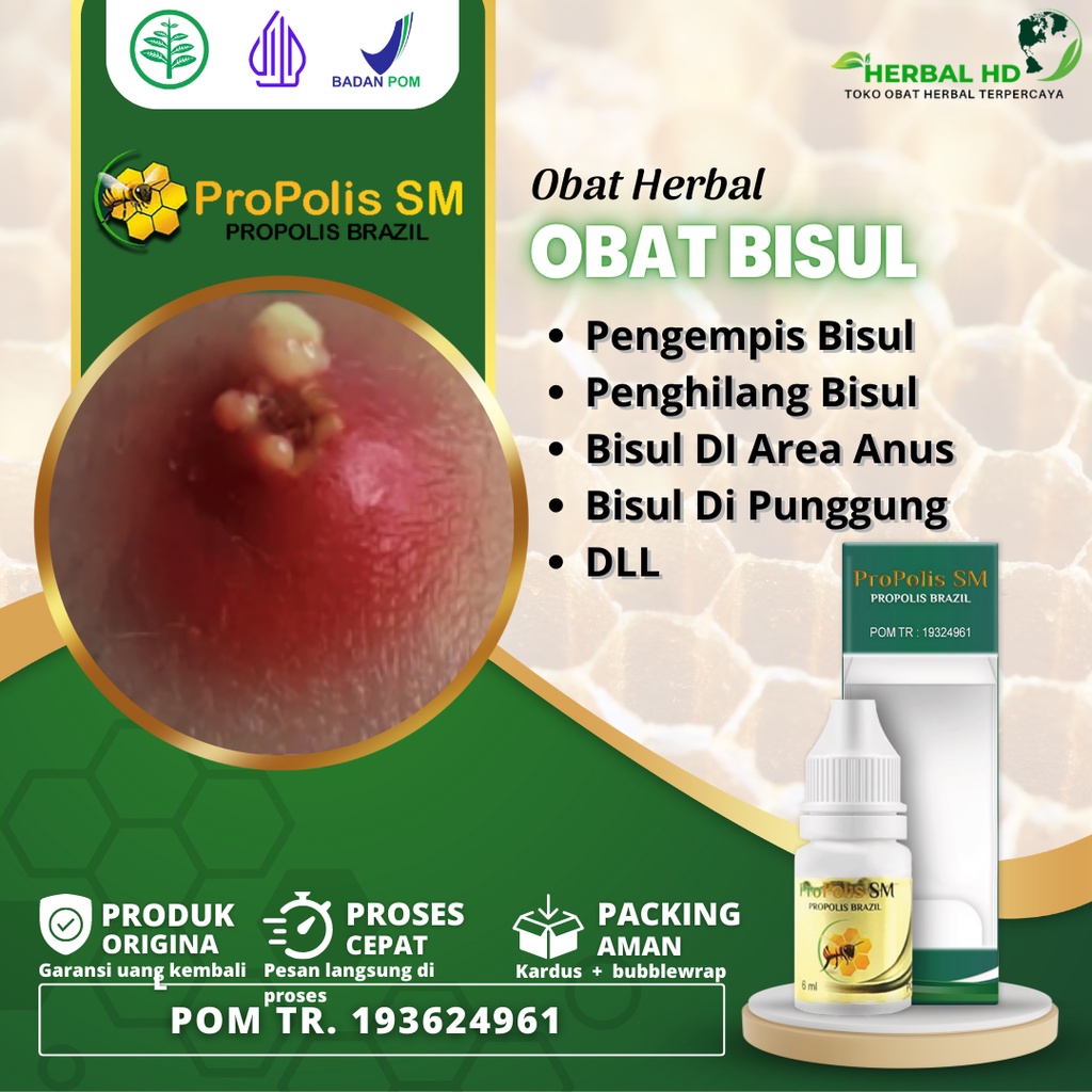 Obat Penjinak Bisul, Obat Penghilang Bisul, Obat Benjolan Kecil Bernanah, Benjolan Kecil Benjolan Be