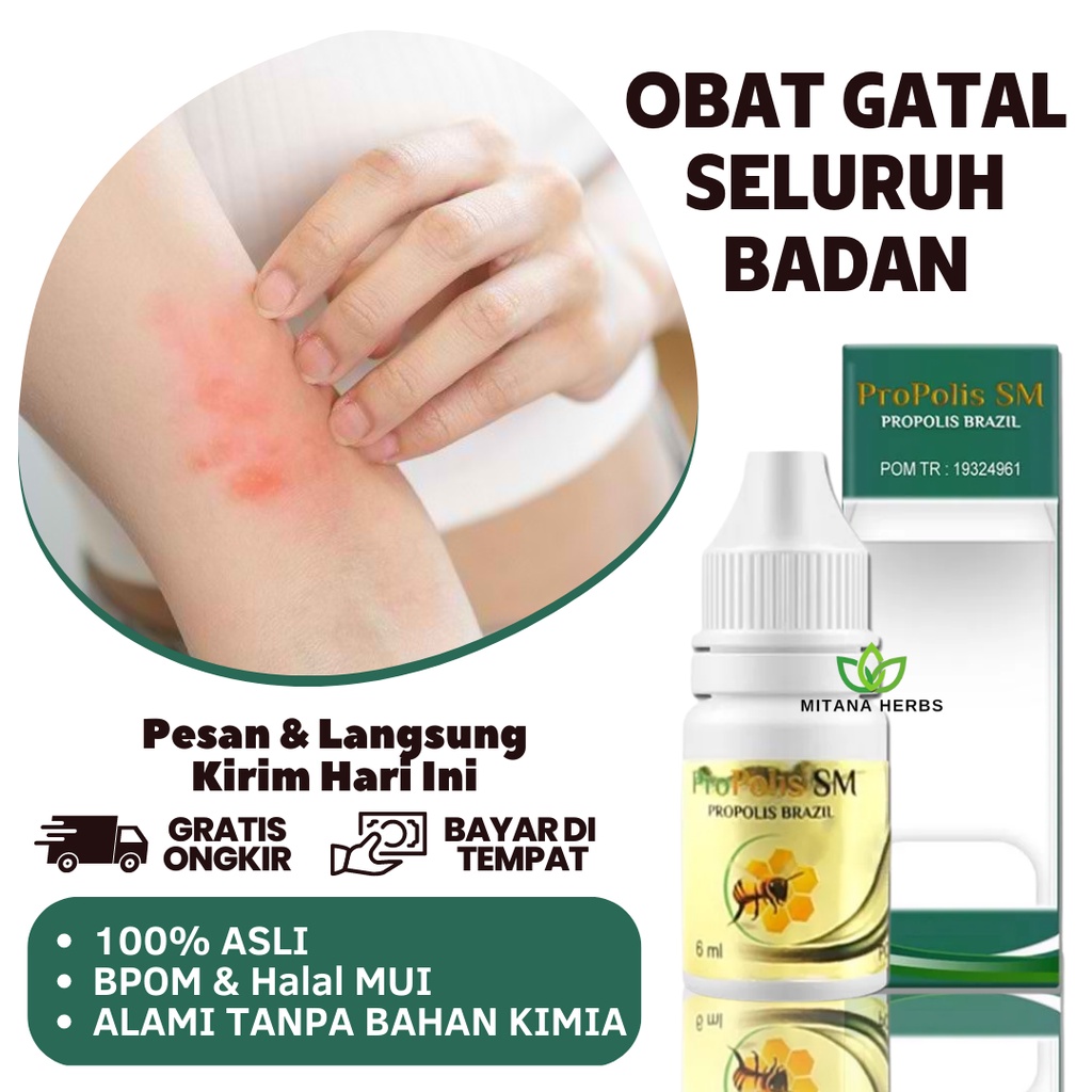 Obat Gatal Di Seluruh Badan, Penghilang Gatal Di Badan, Gatal Di Tubuh, Cacar Air, Cacar Api, Gatal 