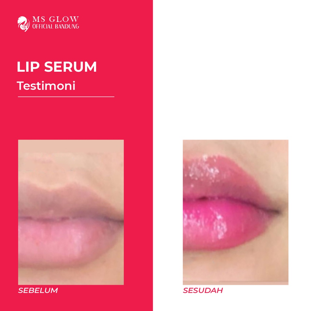 MS glow Lip Serum by Msglowofficialbandung