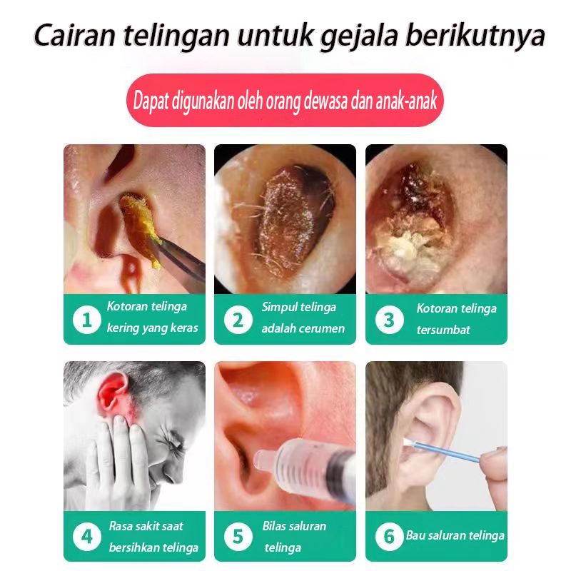 Obat Telinga Bernanah,Obat Telinga Sakit,Obat Tetes Telinga Bernanah, Obat Tetes Telinga Berair, Sakit Telinga, Kuping Sakit, Infeksi Telinga, Telinga Gatal 20ML 100% Asli 【COD】【BPOM】