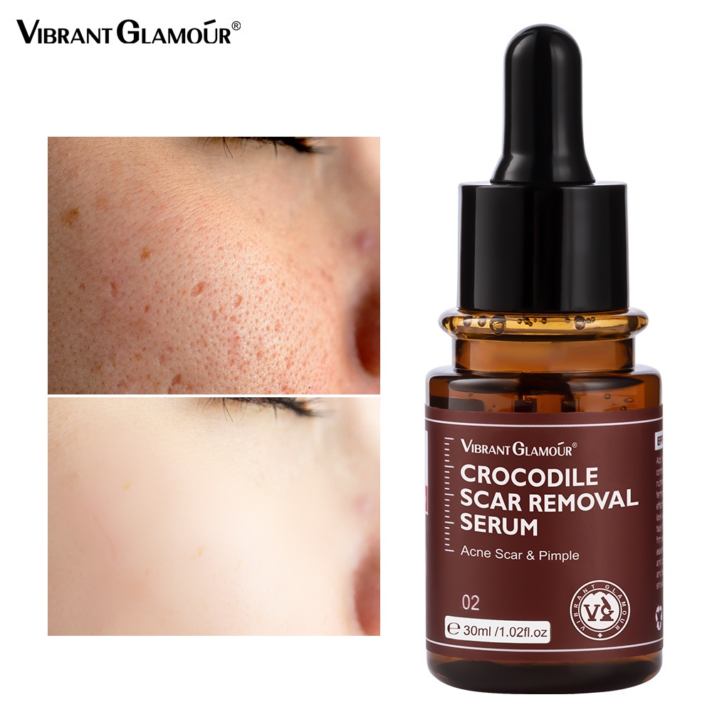 Vibrant Glamour Crocodile Scar Removal Serum 30ml Untuk Penghilang Bekas Luka/Stretch Marks/Jerawat