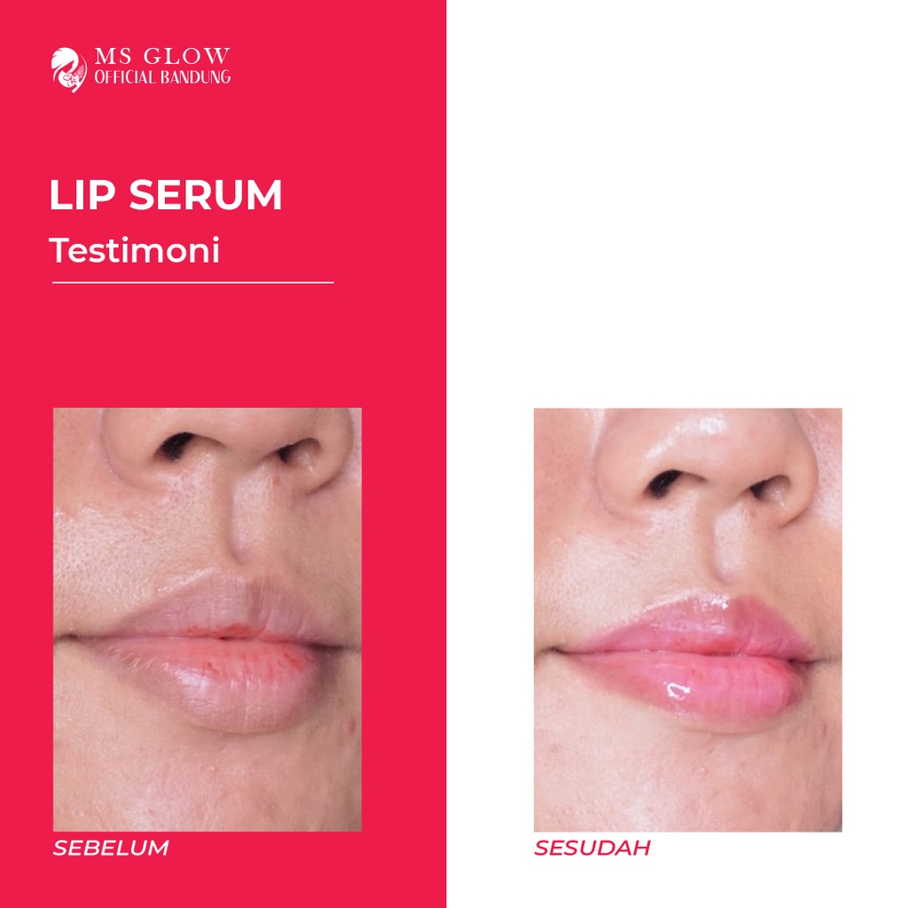 MS glow Lip Serum by Msglowofficialbandung