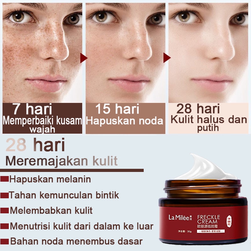 30g Krim bintik La Milee  yang mudah digunakan dirancang untuk menghilangkan chloasma, flek, flek hitam, bintik, jerawat di wajah, dan membersihkan noda di wajah secara mendalam tanpa melukai kulit.