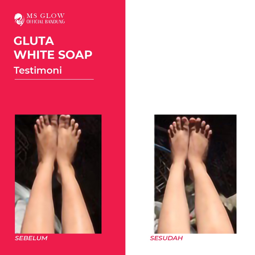 MS glow Gluta White Soap by Msglowofficialbandung