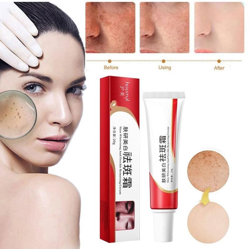 BEOTUA Whitening Freckle Cream Dark Spot Melasm Cream 20Gr Untuk Krim Pelembab Wajah Pemutih Penghilang Flek Hitam Bintik Hitam Perawatan Jerawat