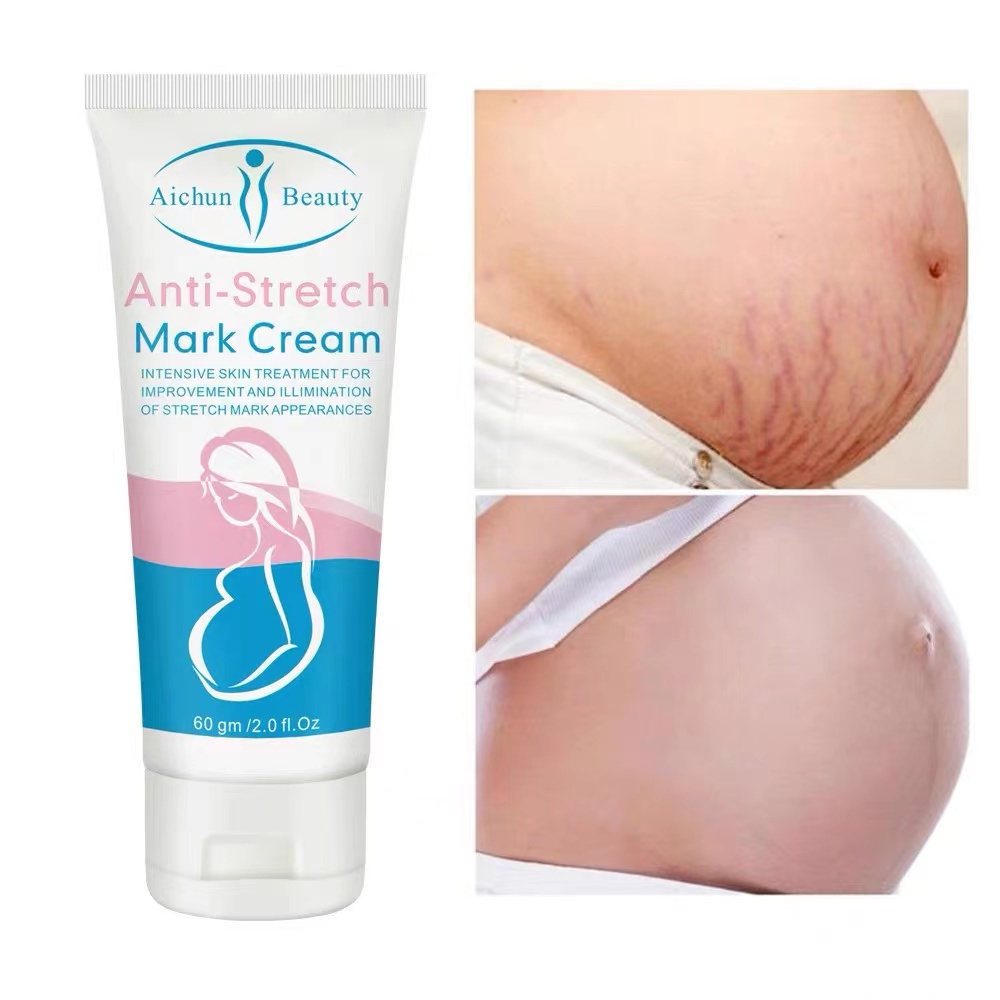 Strechmark Cream Krim Strech Mark Pascamelahirkan Krim Anti Strechmark Penghilang Bekas Luka Aman Untuk Bumil-60G