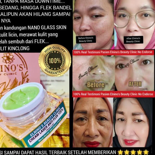 ✾ ELNINO'S CREAM LASER ANTI FLEK NANO GLASS SKIN 125% BEAUTY CLINIC ☛