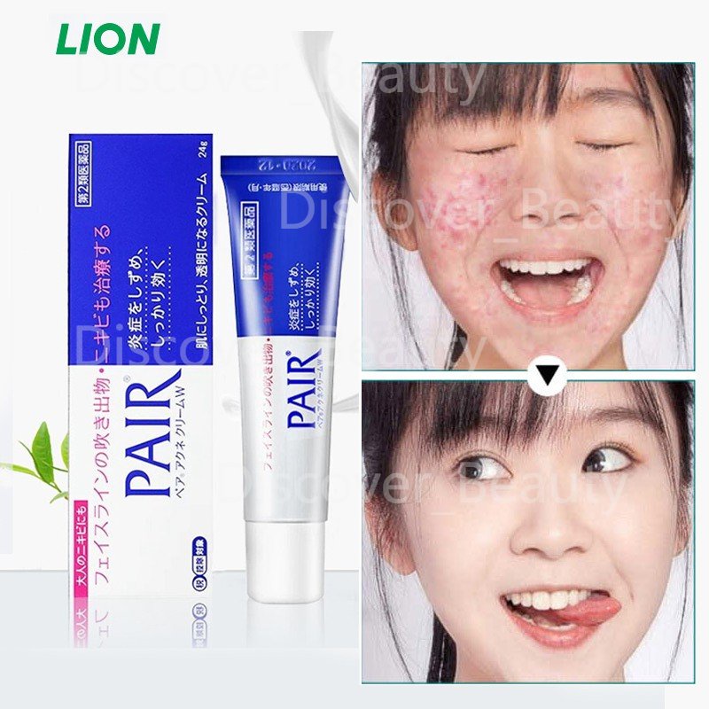 LION PAIR Acne Cream W14g /24g Antibacterial Acne Face Cream