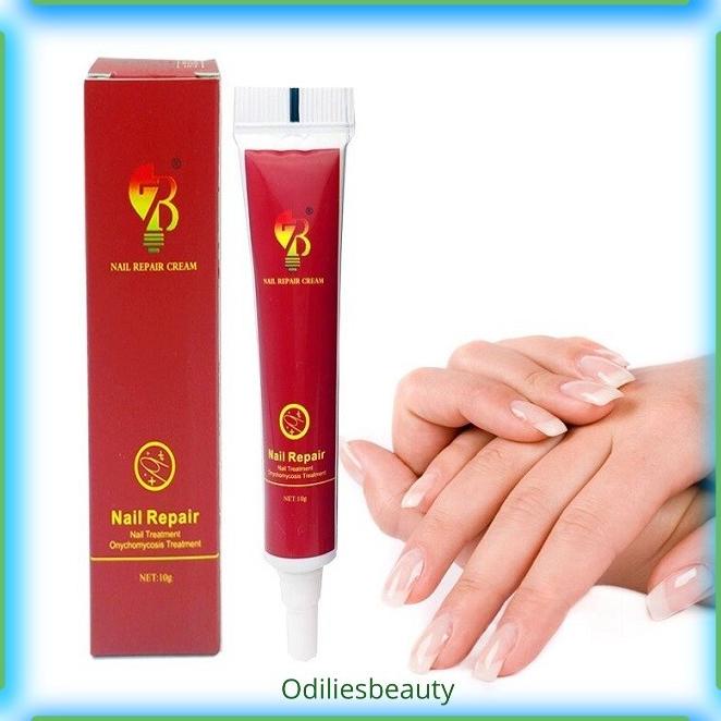 NEW SALEP ANTI JAMUR KUKU ONIKOMIKOSIS PARONYCHIA HERBAL CINA 20 GR STOK TERBATAS